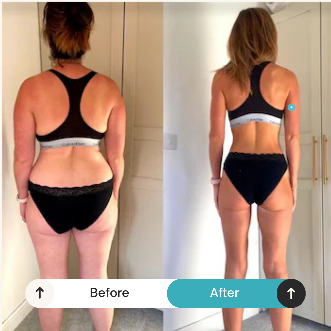 The Original GLP-1 Patches