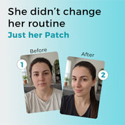 Face Slimming GLP-1 Patches