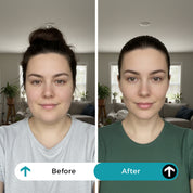 Face Slimming GLP-1 Patches